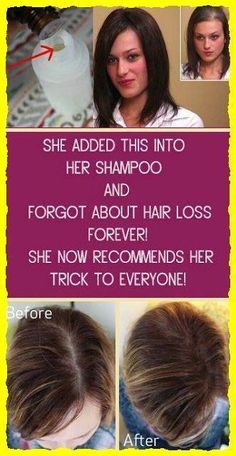 #FemaleHairLossRemedies #QuickHairLossTreatment #HomeRemediesForHairLossInFemales Grow Thick Long Hair, Lost Hair, Hair Problems, Living Tips