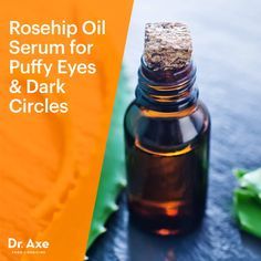 Eye serum for dark circles - Dr. Axe http://www.draxe.com #health #holistic #natural Eye Serum For Dark Circles, Serum For Dark Circles, Aloe Oil, Pure Aloe Vera Gel, Anti Aging Creme, Pure Aloe Vera, Coconut Oil For Skin, Rosehip Seed Oil, Diy Skincare