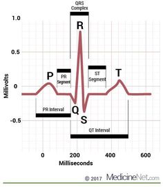 Atrial vs Ventricular Fibrillation: Differences & Similarities Ekg Reading, Normal Ecg, Diagnostic Medical Sonography Student, Nursing School Studying Cheat Sheets, Cartoons Krishna, Ekg Interpretation, Sonography Student, Cardiac Cycle, Medical Assistant Student