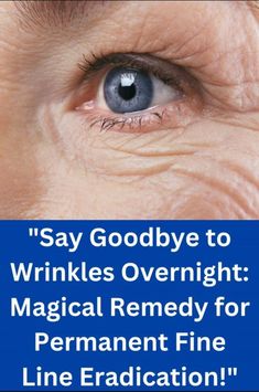 Eliminate Wrinkles, Saggy Skin, Anti Wrinkle Cream, Deep Wrinkles, Wrinkle Cream, Sagging Skin