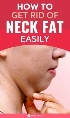 Fat Face Exercises, Jowl Exercises, Loose Face Fat, Chin Reduction, Face Fat, Yoga Hair