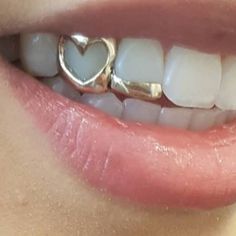 a close up of a person's teeth with a heart ring on top of it