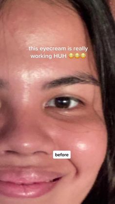 Dark circles, wrinkles, and under-eye bags can be more than just cosmetic concerns; they often signal stress, lack of sleep, or the natural aging process. In this comprehensive guide, we'll delve into the common causes of these under-eye concerns and provide five actionable tips for improvement. Let's transform your Dark Circles Under The Eyes Remedies, Brighten Under Eyes, Dark Circles Under The Eyes, Shaving Tips, Natural Skin Care Remedies, Under Eye Wrinkles