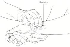 A cool environment may cause peripheral vasoconstriction and reduce the peripheral pulse. Palpation should be done using the fingertips and intensity of the pulse graded on a scale of 0 to 4 +:0 indicating no palpable pulse; 1 + indicating a faint, but detectable pulse; 2 + suggesting a slightly more diminished pulse than normal; 3 + is a normal pulse; and 4 + indicating a bounding pulse. Anatomy Lungs, Vascular System, The Peripheral, Nursing Assessment, Strep Throat, Lungs, Assessment