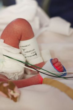 a baby wrapped in bandages laying on top of a bed