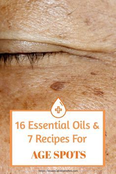 Age Spots Essential Oils, Essential Oils For Age Spots, Get Rid Of Age Spots, Age Spots On Face, Essential Oils For Face, Essential Oils Guide, Essential Oils Herbs, Essential Oils Health