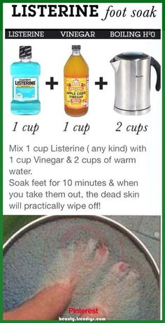 Vinegar Foot Soak, Listerine Foot Soak, Foot Soak Recipe, Foot Soak, Juice Recipes, Beauty Remedies, Natural Health Remedies, Diy Skin