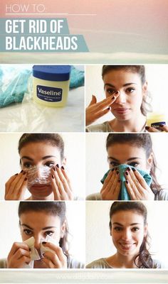 DDG DIYHow to get rid of blackheads at homeskincare make your mug glow how tos feature ddg diy beauty tips beauty 2 beauty 2 picture: Rid Of Blackheads, Remove Blackheads, Get Rid Of Blackheads, Beauty Remedies, Unwanted Hair Removal, Health Ideas, Diy Beauty Hacks, Beauty Tricks, Unwanted Hair