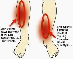 the diagram shows how to do shin splints down the front of the leg