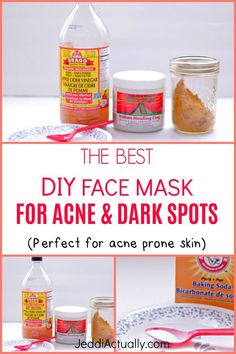 Wondering how to get rid of skin discolorations and get clear skin? I put together this gentle, chemical free DIY face mask that will help you go get rid of dark spots and acne in a short time. Check it out! Black Spots On Face, Best Diy Face Mask, Brown Age Spots, Get Clear Skin, Brown Spots On Skin, Indian Healing Clay, Acne Dark Spots, Healing Clay, Brown Spots Removal