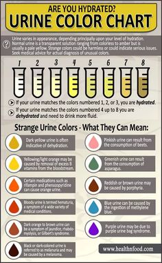 the color chart for urine is shown in this poster