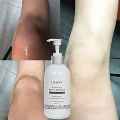 OEM ODM Wholesale Body Care Lightening Whitening Camellia Oil Body Lotion Certification : MSDS, GMP, FDA, CE. Certification : MSDS, GMP, FDA, CE, TUV. Main Ingredient : Pearl, Glycerin, Dead Sea Salt. Feature : Whitening, Nourishing, Moisturizer, Lightening. Gender : Female. Age Group : Adults. Form : Lotion. Function : Whitening Effect. Advantage : Natural Formula. Sample : Availabe Samples. OEM : Welcmed. Quality : High Quality. Shipment : by Air, Express or by Sea. Effect : Nourishing Moistur Whitening Products Body Skin, Best Whitening Lotion, Skin Lightening Products, Body Whitening Cream, Whitening Cream For Face, Body Whitening, Skin Lightening Cream, Skin Care Makeup