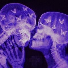 an x - ray image of two people kissing each other