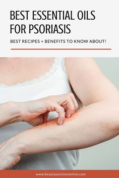 Discover the best essential oils for psoriasis Snoring Solutions, Essential Oil Carrier Oils, Natural Beauty Care, Eye Exercises, Skin Detox, Best Essential Oils, Health Inspiration, Skin Issues