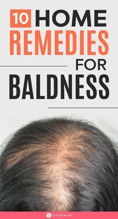 Hair Fall Remedy, Natural Hair Remedies, Hair Remedies For Growth, Home Remedies For Hair, Regrow Hair, Brittle Nails, Hair Control, Lost Hair