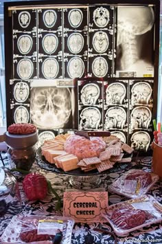 a table topped with lots of different types of food and medical images on the wall