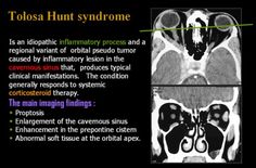 an x - ray shows the different areas in which there is no image to describe