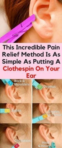 Ear Reflexology, Bolesti Chrbta, Acupressure Points, Natural Health Remedies, Back Pain Relief, Pressure Points, Reflexology, Health And Beauty Tips, Health Info