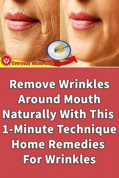 Within weeks I noticed tighter and hydrated skin, reduced wrinkles and age spots, as well as radiance and glow #skincare #darkspots #acne #removewrinkles #wrinkles #antiaging #facemask Skin Tightening Essential Oil, Wrinkles Around Mouth, Home Remedies For Wrinkles, Homemade Wrinkle Cream, Glow Skincare