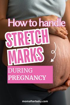 You might notice during your prenatal visit or at anytime throughout your pregnancy those shiny little lines appearing on your belly bump, those would be stretch marks. Today, we're going to help you understand why some women get them, along with certain skincare treatments that might be worth looking into. Belly Bump, Pregnant Mom, Skin Care Treatments