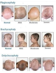 the different types of hair for babies and toddlers with pictures on each side of them