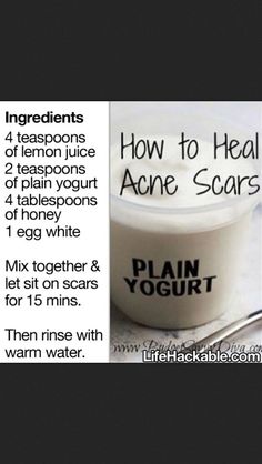 Acne Scar Remover Acne Scar Removal, Diy Skin Care, Diy Skin, How To Treat Acne, Homemade Beauty Products, Health And Beauty Tips