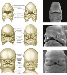 four different views of the human head and neck, including an occipitus