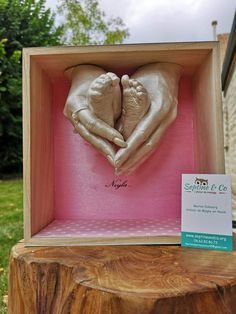 two baby feet in a pink box on top of a tree stump with a sign