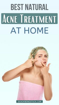 Treat Acne Naturally, Cystic Acne Remedies, Remedies For Acne, Forehead Acne, Skincare Acne, Natural Acne Remedies, Natural Acne, Home Remedies For Acne, Acne Causes