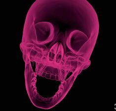 an x - ray image of a human skull showing the teeth and upper part of the head