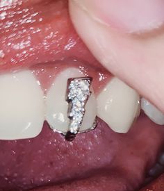 Teeth Bling, Mouth Jewelry, Tooth Jewellery, Opals Jewelry, Veneers Teeth