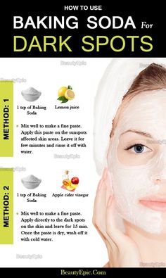 Baking Soda for Dark Spots Brown Spots On Skin, Dark Spots On Face, Brown Spots Removal, Brown Spots On Face, Dark Spots On Skin, Skin Spots, Spots On Face, Baking Soda Shampoo, Remove Dark Spots