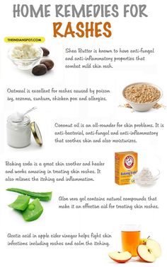 Home Remedies For Rashes, Skin Rashes, Allergy Remedies, Home Remedies For Acne, Skin Care Remedies