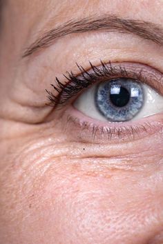 Wrinkles Around The Eyes, Wrinkles Art, Face Wrinkle, Art Assessment, Facial Exercise, Eye Wrinkles, Eye Sight, Face Yoga Exercises, Minimize Wrinkles