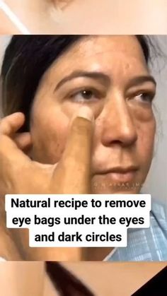 Diy Eye Bags, Facial Tips, Wrinkle Remedies, Eye Puffiness, Face Yoga Facial Exercises, Skin Face Mask, Plastic Vase