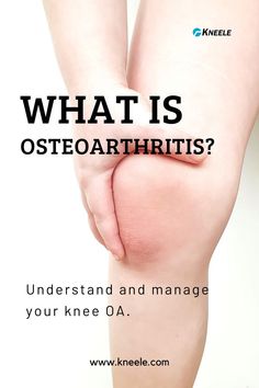 Osteoarthritis (OA) of the knee occurs when the structure of the joint becomes damaged. People over 45 are more at risk, but younger people can be affected too. Exercise and weight loss are two of the best ways to manage your knee OA. #kneeoa #oakneepain #oainknees #osteoarthritis #osteoarthritispain #osteoarthritisknee #kneejoint #kneeinjuries Damaged People, Bone Strengthening, Bone Healing, Knee Pain Remedy, Knee Strengthening Exercises, How To Strengthen Knees, Knee Pain Exercises