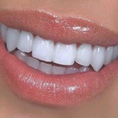 Canine Teeth Human Aesthetic, Natural Fangs Teeth, Celebrity Teeth, Perfect Smile Teeth, Teeth Fangs, Getting Braces, Diamond Teeth