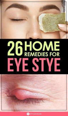 Sty In Eye Remedies, Get Rid Of Stye, Stye Remedy, Eye Stye Remedies, Home Remedies For Bronchitis, Swollen Eyes, Eye Infections