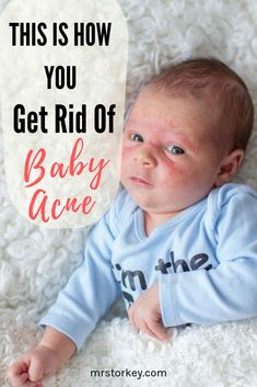 a baby laying on top of a white rug with the words, this is how you get rid of baby acne