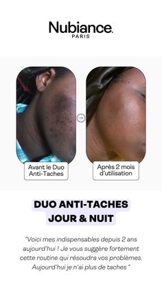 Ce duo est incontournable pour une peau impeccable ! #hyperpigmentation #duoantitaches #soinantitaches #tachesvisage Skincare Tips, Cosmetics Brands, Personal Branding, Made In France, Vision Board, Women's Fashion, Skin Care, Skin, Makeup