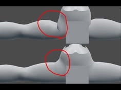 two different views of the arm with red circles