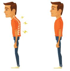 Fix Hunchback, Hunchback Posture, Dowager's Hump, Neck And Shoulder Exercises, Forward Head Posture, Simple Exercise