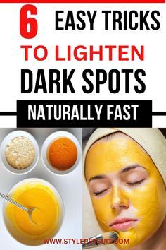 Dark Spots On Face Remove, Dark Spot Corrector Diy Natural, Dark Spot Remover For Face Black Skin, How To Get Rid Of Dark Spots On Buttocks, Removing Dark Spots On Skin, Homemade Dark Spot Remover, Diy Tumeric Mask For Dark Spots