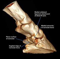 an image of the foot bones