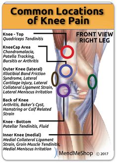 10 Common Knee Injuries & Diseases Patellar Chondromalacia, Common Knee Injuries, Ligament Injury