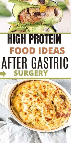 High Protein Foods For Gastric Bypass Patients High Protein Bariatric Recipes, Full Liquid Diet, Liquid Diet Recipes, Bariatric Recipes Sleeve, Gastric Bypass Recipes, Bariatric Meals, Soft Foods Diet, Low Carb Foods, High Protein Meals