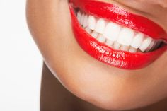 Natural Teeth Whitening Remedies, Best Teeth Whitening Kit, Dental Implants Cost, Teeth Whitening Remedies, Laser Teeth Whitening, Teeth Bleaching, Pasta Dental, Implant Dentistry, Nice Teeth