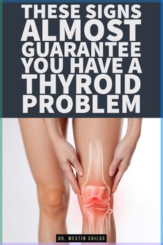 10% to 20% of the population have this hormone imbalance and it’s called hypothyroidism. Hypothyroidism, what is it? It’s a state of low thyroid function and it’s almost always caused by an autoimmune disease. This Thyroid Healing, Low Thyroid, Hashimotos Disease, Thyroid Function, Thyroid Gland