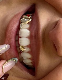 a close up of a person's mouth with teeth and gold rings on it