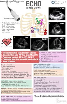 an info sheet describing the different types of medical devices and their functions in the human body